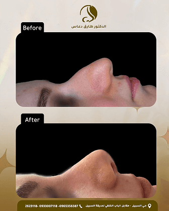 صورة توثيقية لحالة قبل وبعد العلاج 1