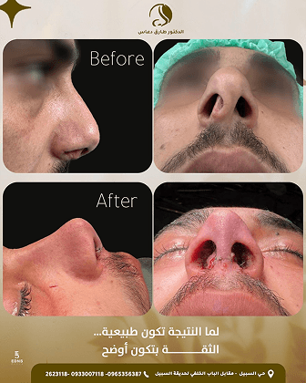 صورة توثيقية لحالة قبل وبعد العلاج 3